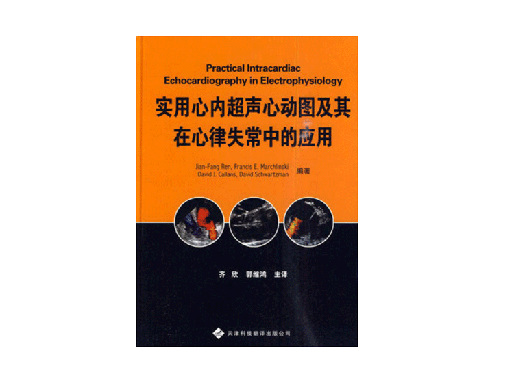 实用心内超声心动图及其在心律失常中的应用作者美任建方等编著齐欣