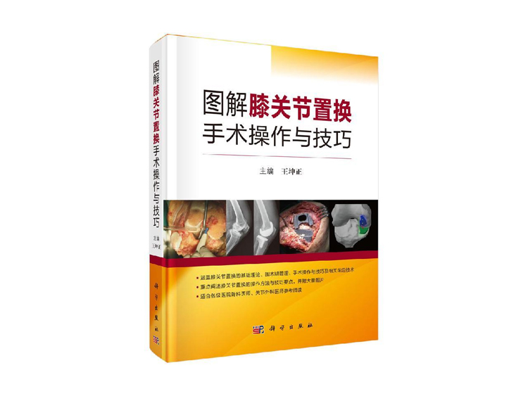 骨科医生诊治距骨骨软骨损伤的临床指南，欲购从速！