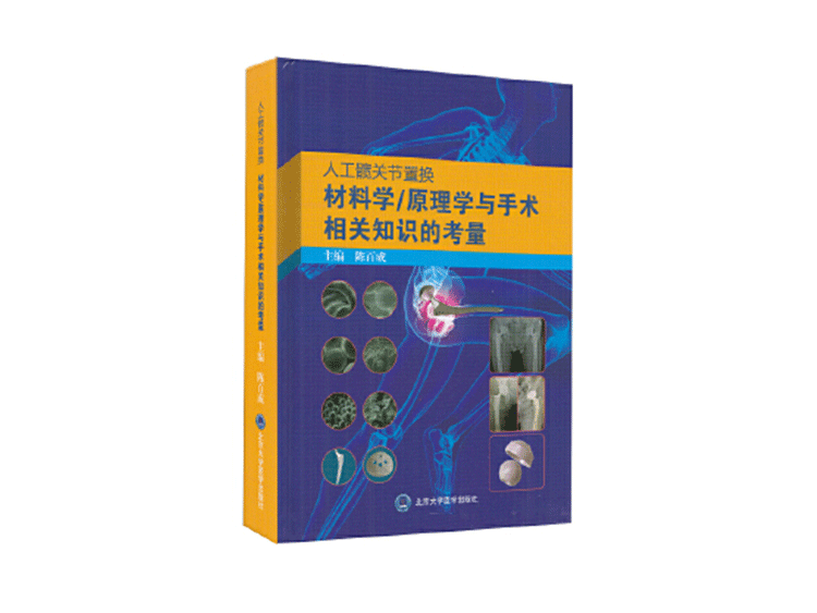 骨科医生诊治距骨骨软骨损伤的临床指南，欲购从速！