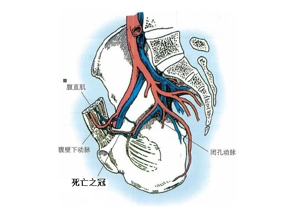 骨科最常用的钢板,你全都了解了吗?