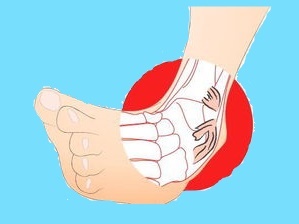 微创技术在踝关节骨折中的应用