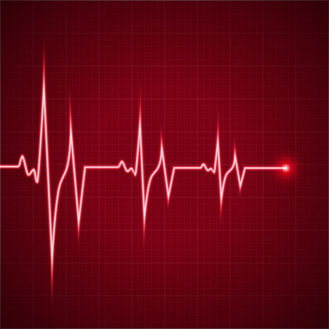 急性心肌梗死的心电图快速定位及临床意义