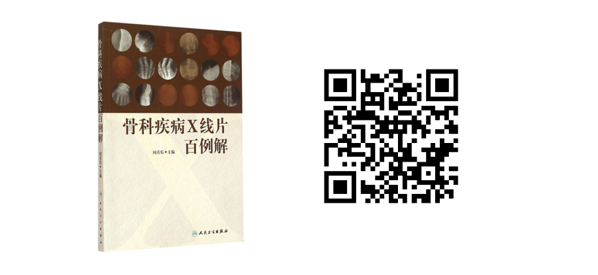 其他5.png 新春特惠-骨科图书低至6折